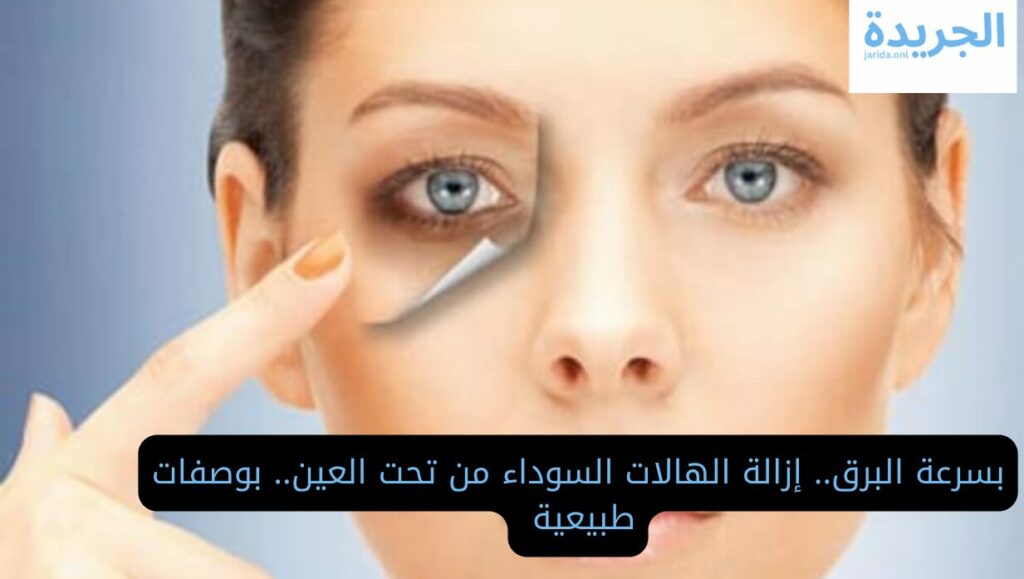 إزالة الهالات السوداء