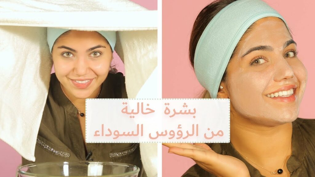 حمام البخار لإزالة الرؤوس السوداء