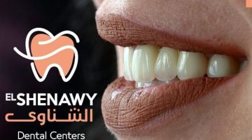 أسعار تبييض الأسنان في مصر 2025: دليل شامل لتكاليف الابتسامة المثالية