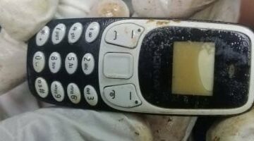 هاتف فى معدة مريض منذ عامين.. واقعة طبية نادرة بمستشفى الأزهر في أسيوط